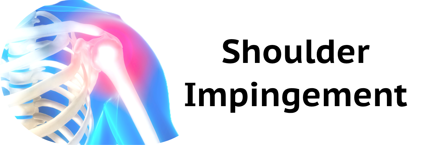 Shoulder Impingement Syndrome MiChiro